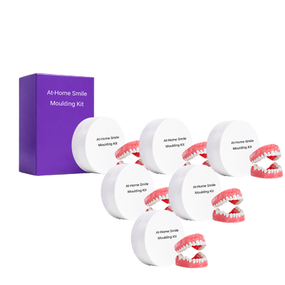 At-Home Smile Moulding Kit